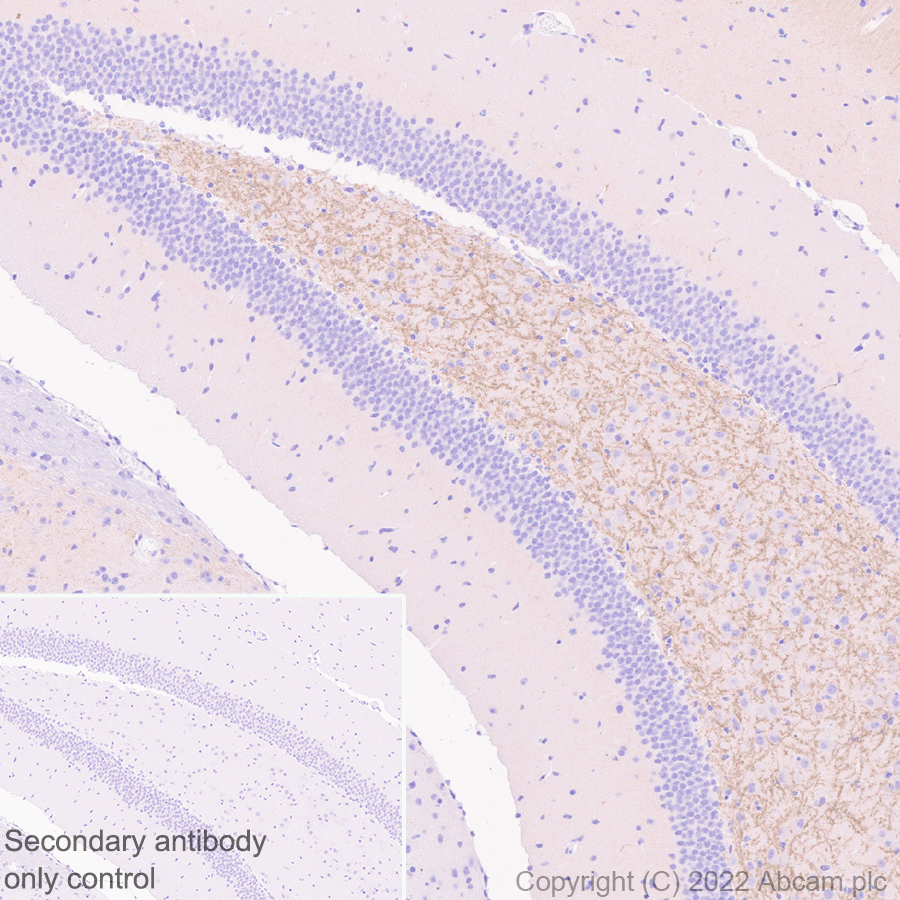 Immunohistochemistry (Formalin/PFA-fixed paraffin-embedded sections) - Anti-Metabotropic Glutamate Receptor 7/MGLUR7 antibody [EPR24530-11] (ab302530), expandable thumbnail