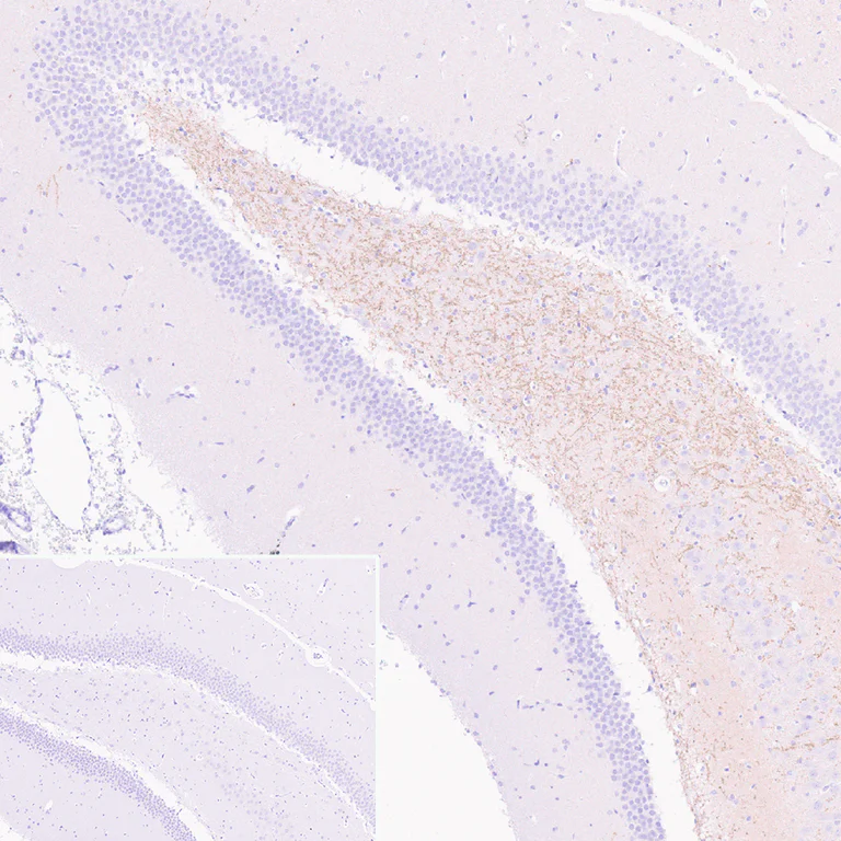 Immunohistochemistry (Formalin/PFA-fixed paraffin-embedded sections) - Anti-Metabotropic Glutamate Receptor 7/MGLUR7 antibody [EPR24530-11] (AB302530)