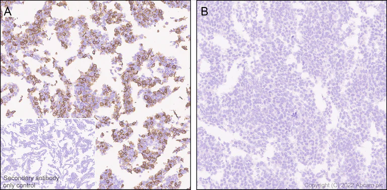 Immunohistochemistry (Formalin/PFA-fixed paraffin-embedded sections) - Anti-Metabotropic Glutamate Receptor 7/MGLUR7 antibody [EPR24530-11] (AB302530)