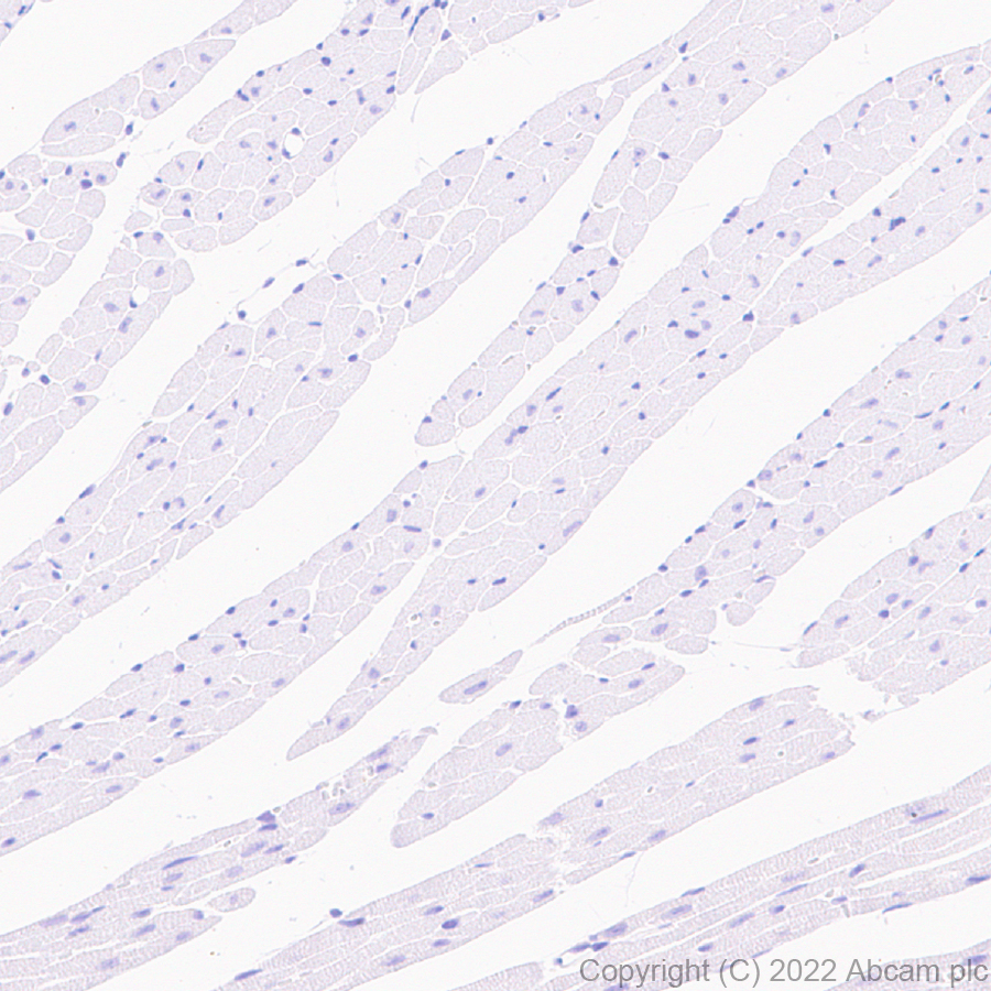 Immunohistochemistry (Formalin/PFA-fixed paraffin-embedded sections) - Anti-Metabotropic Glutamate Receptor 7/MGLUR7 antibody [EPR24530-11] (AB302530), expandable thumbnail
