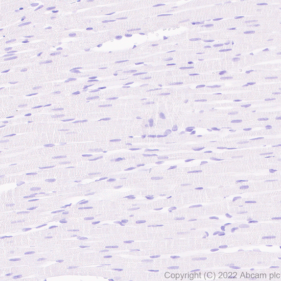 Immunohistochemistry (Formalin/PFA-fixed paraffin-embedded sections) - Anti-Metabotropic Glutamate Receptor 7/MGLUR7 antibody [EPR24530-11] (AB302530), expandable thumbnail