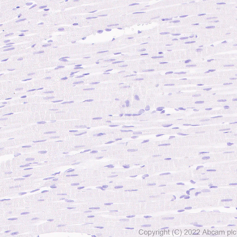 Immunohistochemistry (Formalin/PFA-fixed paraffin-embedded sections) - Anti-Metabotropic Glutamate Receptor 7/MGLUR7 antibody [EPR24530-11] (AB302530)