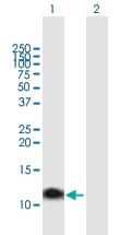 Western blot - Anti-Metallothionein antibody (AB172069)