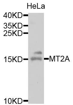 Western blot - Anti-Metallothionein antibody (AB192385)