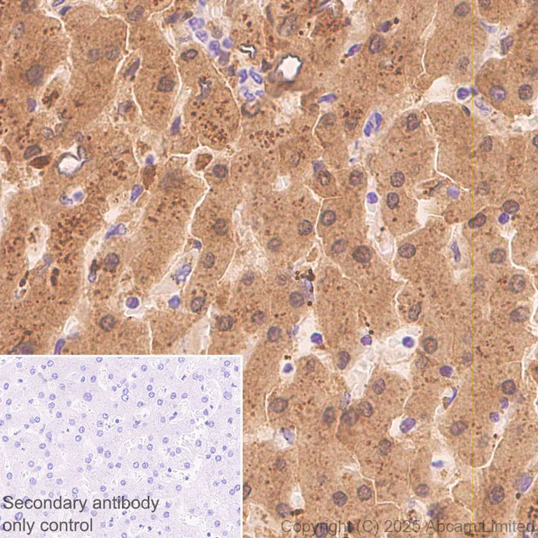 Immunohistochemistry (Formalin/PFA-fixed paraffin-embedded sections) - Anti-Metallothionein antibody [EPR29104-22] (AB325177)