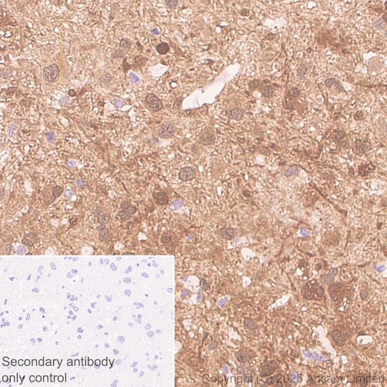 Immunohistochemistry (Formalin/PFA-fixed paraffin-embedded sections) - Anti-Metallothionein antibody [EPR29104-22] (AB325177)