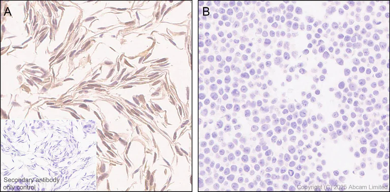 Immunohistochemistry (Formalin/PFA-fixed paraffin-embedded sections) - Anti-Metallothionein antibody [EPR29104-22] - BSA and Azide free (AB325189)