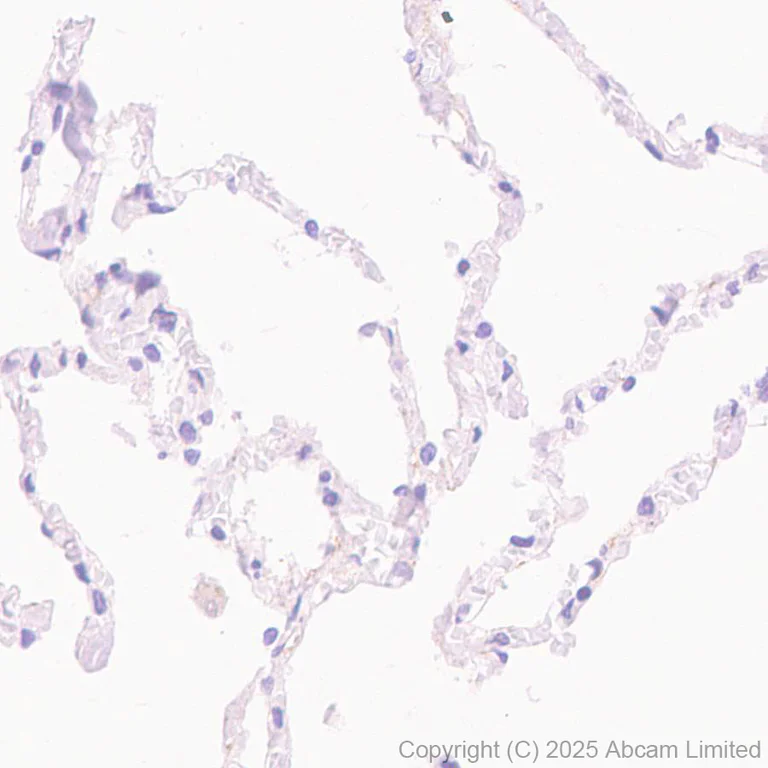 Immunohistochemistry (Formalin/PFA-fixed paraffin-embedded sections) - Anti-Metallothionein antibody [EPR29104-22] - BSA and Azide free (AB325189)