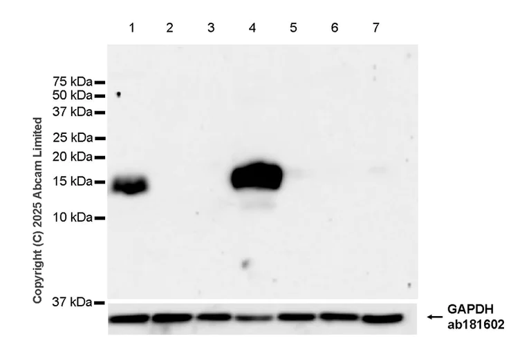 Western blot - Anti-Metallothionein antibody [EPR29104-22] - BSA and Azide free (AB325189)