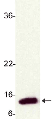 Western blot - Anti-Metallothionein antibody [UC1MT] (AB12228)