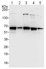 Western blot - Anti-Methionine Aminopeptidase 2/p67 antibody (AB123523)