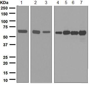 Western blot - Anti-Methionine Aminopeptidase 2/p67 antibody [EPR6886(B)] - BSA and Azide free (AB248071), expandable thumbnail