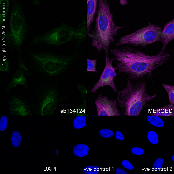 Immunocytochemistry/ Immunofluorescence - Anti-Methionine Aminopeptidase 2/p67 antibody [EPR6887] (AB134124)