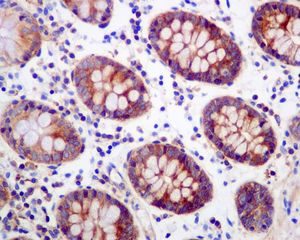 Immunohistochemistry (Formalin/PFA-fixed paraffin-embedded sections) - Anti-Methionine Aminopeptidase 2/p67 antibody [EPR6887] (AB134124)