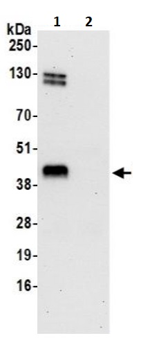 Immunoprecipitation - Anti-Methionyl Aminopeptidase 1/MAP 1 antibody (AB241293)