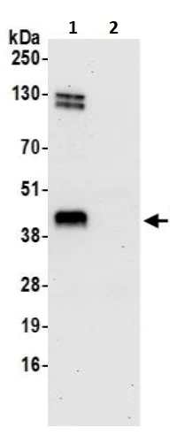 Immunoprecipitation - Anti-Methionyl Aminopeptidase 1/MAP 1 antibody (AB241293)