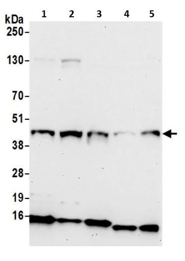 Western blot - Anti-Methionyl Aminopeptidase 1/MAP 1 antibody (AB241293)