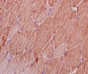Immunohistochemistry (Formalin/PFA-fixed paraffin-embedded sections) - Anti-Methionyl Aminopeptidase 1/MAP 1 antibody [EPR15452(B)] (AB185540)