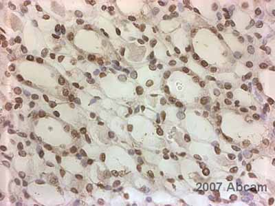 Immunohistochemistry (Formalin/PFA-fixed paraffin-embedded sections) - Anti-Methylated Lysine (di methyl , mono methyl ) antibody (AB23366)