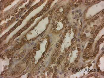 ぴ。ページ BEN DAVIS（ベンデイビス）】JAGGED LOGO ZIP HOODIE /パーカー