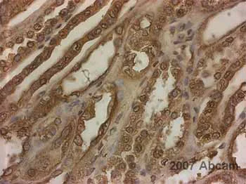 Anti-Methylated Lysine (di methyl , mono methyl ) antibody