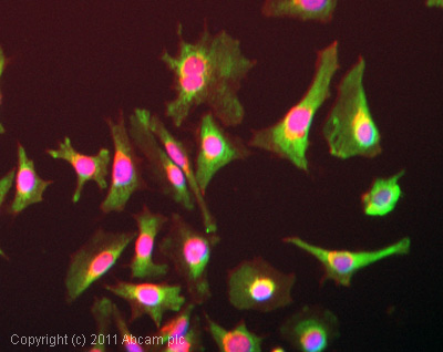 Immunocytochemistry/ Immunofluorescence - Anti-Methylmalonyl Coenzyme A mutase antibody (AB67869), expandable thumbnail