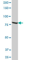 Western blot - Anti-Methylmalonyl Coenzyme A mutase antibody (AB67869), expandable thumbnail