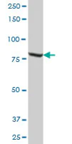 Western blot - Anti-Methylmalonyl Coenzyme A mutase antibody (AB67869)