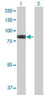Western blot - Anti-Methylmalonyl Coenzyme A mutase antibody (AB67869), expandable thumbnail