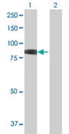 Western blot - Anti-Methylmalonyl Coenzyme A mutase antibody (AB67869)
