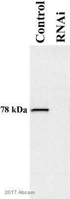 Western blot - Anti-Methylmalonyl Coenzyme A mutase antibody (AB67869)