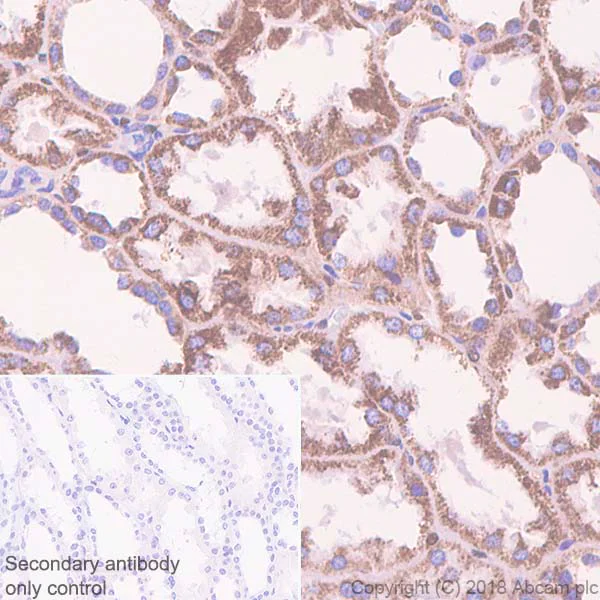 Immunohistochemistry (Formalin/PFA-fixed paraffin-embedded sections) - Anti-Methylmalonyl Coenzyme A mutase antibody [EPR7738] (AB134956)