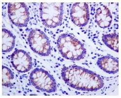 Immunohistochemistry (Formalin/PFA-fixed paraffin-embedded sections) - Anti-Methylmalonyl Coenzyme A mutase antibody [EPR7738] (AB134956), expandable thumbnail
