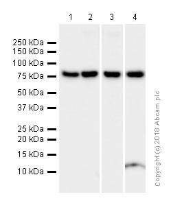 Western blot - Anti-Methylmalonyl Coenzyme A mutase antibody [EPR7738] (AB134956), expandable thumbnail