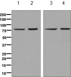 Western blot - Anti-Methylmalonyl Coenzyme A mutase antibody [EPR7738] (AB134956), expandable thumbnail