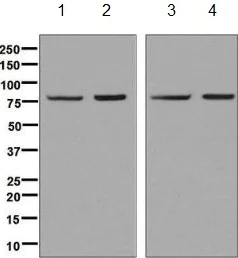 Western blot - Anti-Methylmalonyl Coenzyme A mutase antibody [EPR7738] (AB134956)