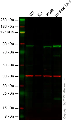 Western blot - Anti-Methylmalonyl Coenzyme A mutase antibody [EPR7738] (AB134956)