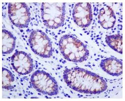 Immunohistochemistry (Formalin/PFA-fixed paraffin-embedded sections) - Anti-Methylmalonyl Coenzyme A mutase antibody [EPR7738] - BSA and Azide free (AB240091)