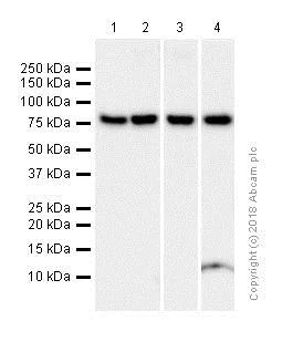 Western blot - Anti-Methylmalonyl Coenzyme A mutase antibody [EPR7738] - BSA and Azide free (AB240091)
