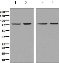 Western blot - Anti-Methylmalonyl Coenzyme A mutase antibody [EPR7738] - BSA and Azide free (AB240091)