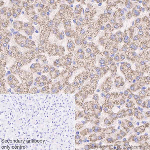 Anti-Methylmalonyl Coenzyme A mutase antibody [EPR7739]