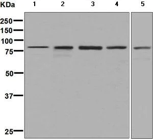 Western blot - Anti-Methylmalonyl Coenzyme A mutase antibody [EPR7739] (AB133672)