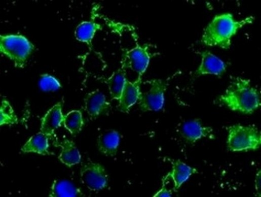 Immunocytochemistry/ Immunofluorescence - Anti-Methylmalonyl Coenzyme A mutase antibody [EPR7739] - BSA and Azide free (AB236068)
