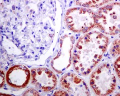 Immunohistochemistry (Formalin/PFA-fixed paraffin-embedded sections) - Anti-Methylmalonyl Coenzyme A mutase antibody [EPR7739] - BSA and Azide free (AB236068)