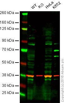Western blot - Anti-Methylmalonyl Coenzyme A mutase antibody [EPR7739] - BSA and Azide free (AB236068)