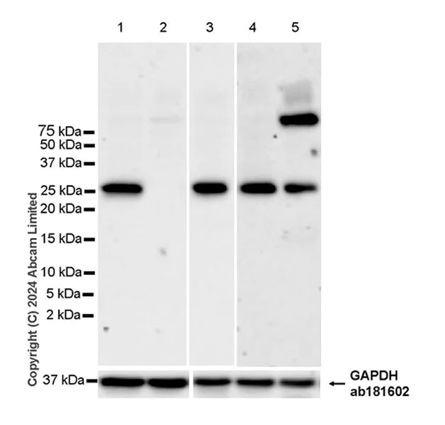 Western blot - Anti-Methyltransferase like 5 antibody [EPR27864-16] (AB319142)
