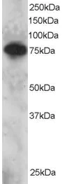 Western blot - Anti-Metnase antibody (AB3823)