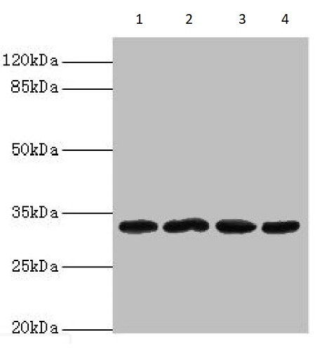 Western blot - Anti-METRNL antibody (AB235775), expandable thumbnail