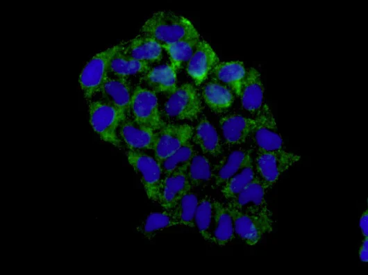 Immunocytochemistry/ Immunofluorescence - Anti-MetRS/MARS antibody [EPR9872] (AB180497)