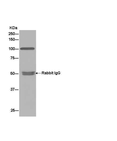 Immunoprecipitation - Anti-MetRS/MARS antibody [EPR9872] (AB180497)